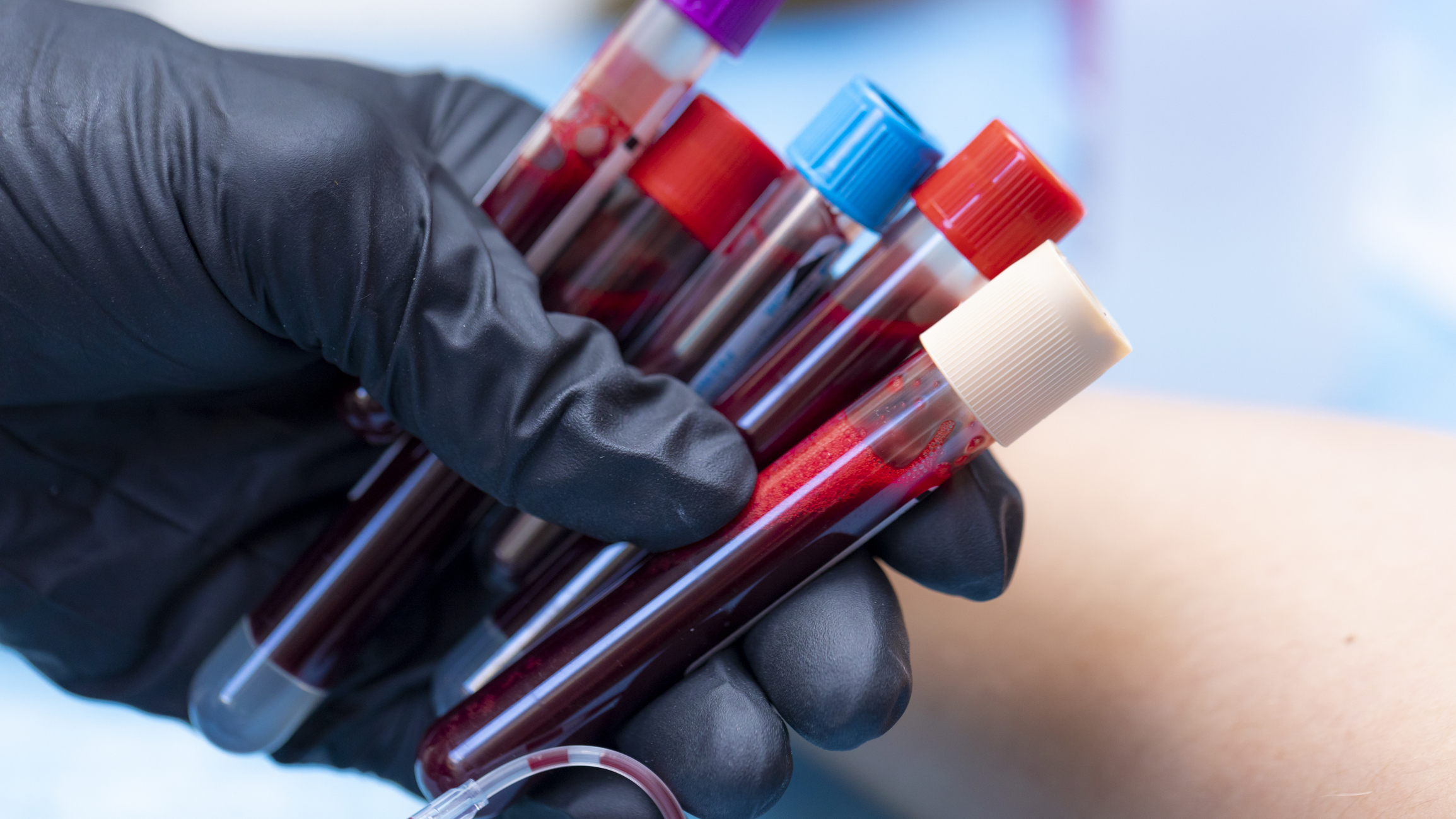 Blood Substitutes: How Distant Is This Future of Patient Care?